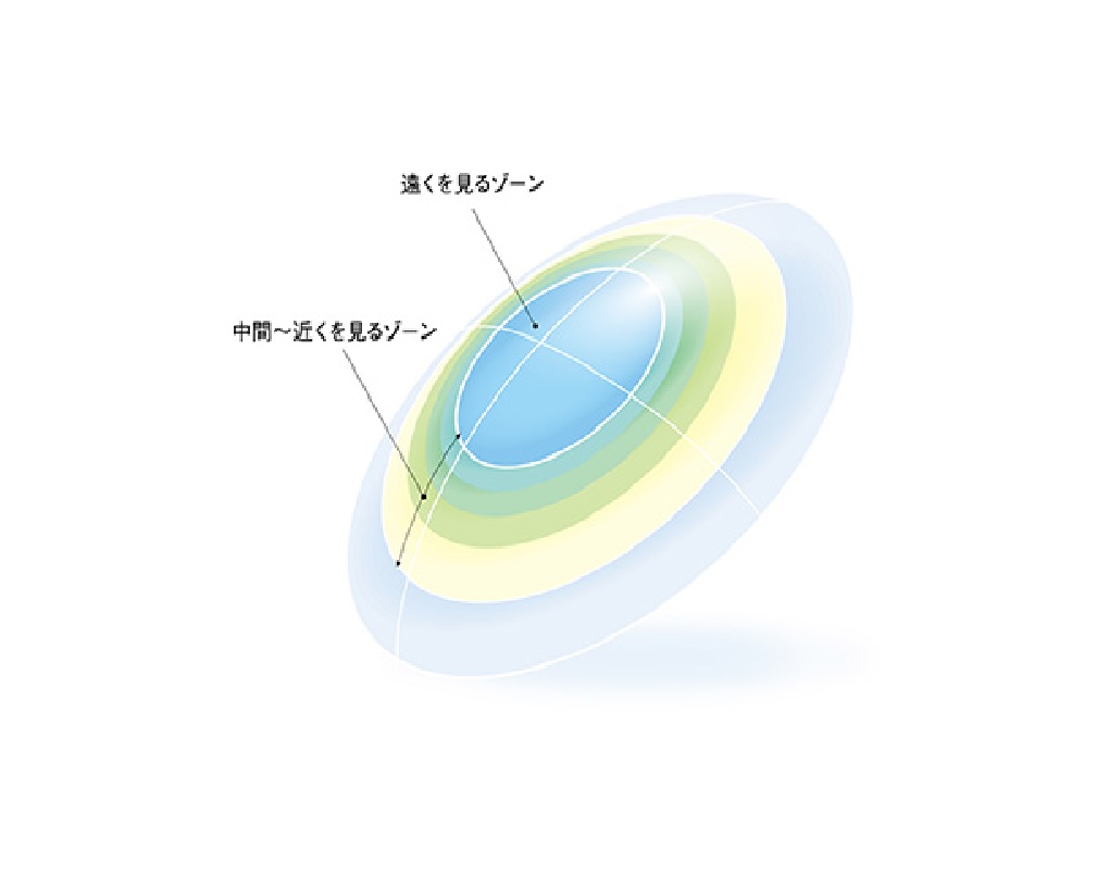 シードマルチフォーカルO2ノア（検査時要予約)